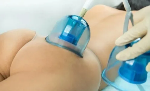 What Are the Best Non-Surgical Body Contouring Treatments for Stubborn Fat?