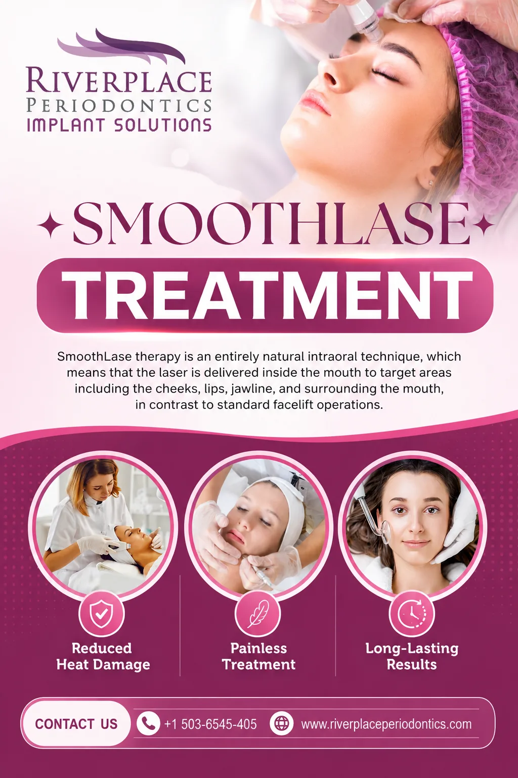Can SmoothLase Treatment Improve Skin Elasticity?