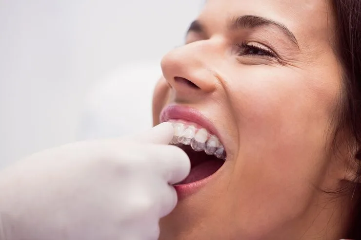 Best Dental Clinic for Invisible Aligners in Kukatpally: Expert Orthodontists