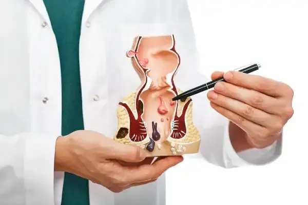 Why Does Fistula Cause Bad Smell?