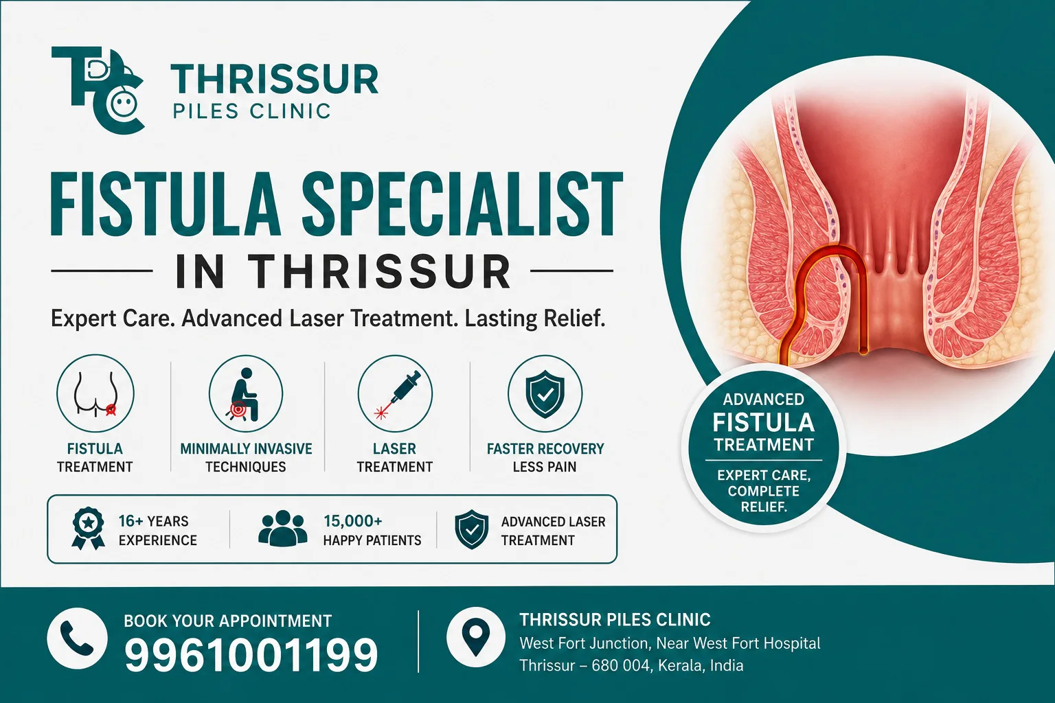 Finding the Best Fistula Specialist in Thrissur: Your Guide to Permanent Relief