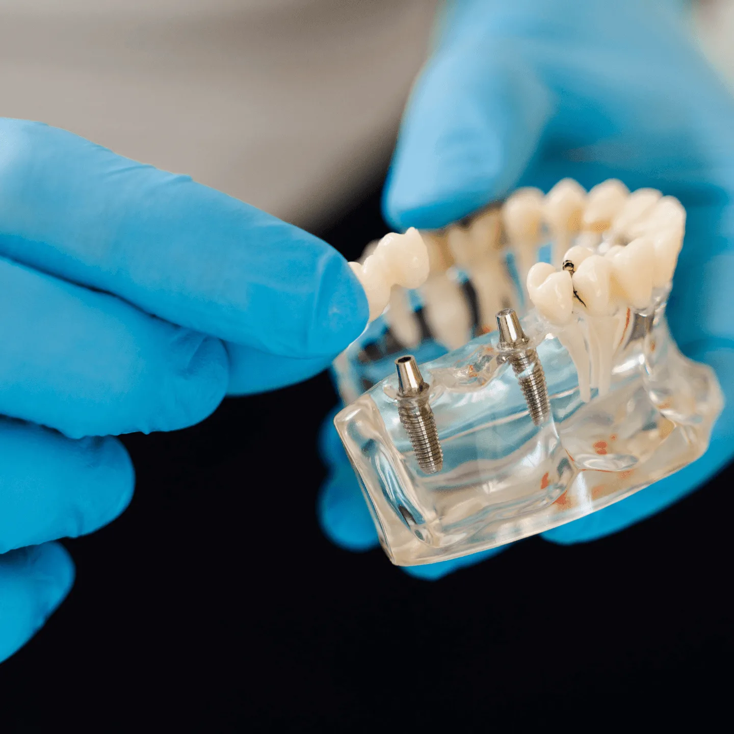 How to Find the Best Dentist in Temecula for Complex Dental Needs