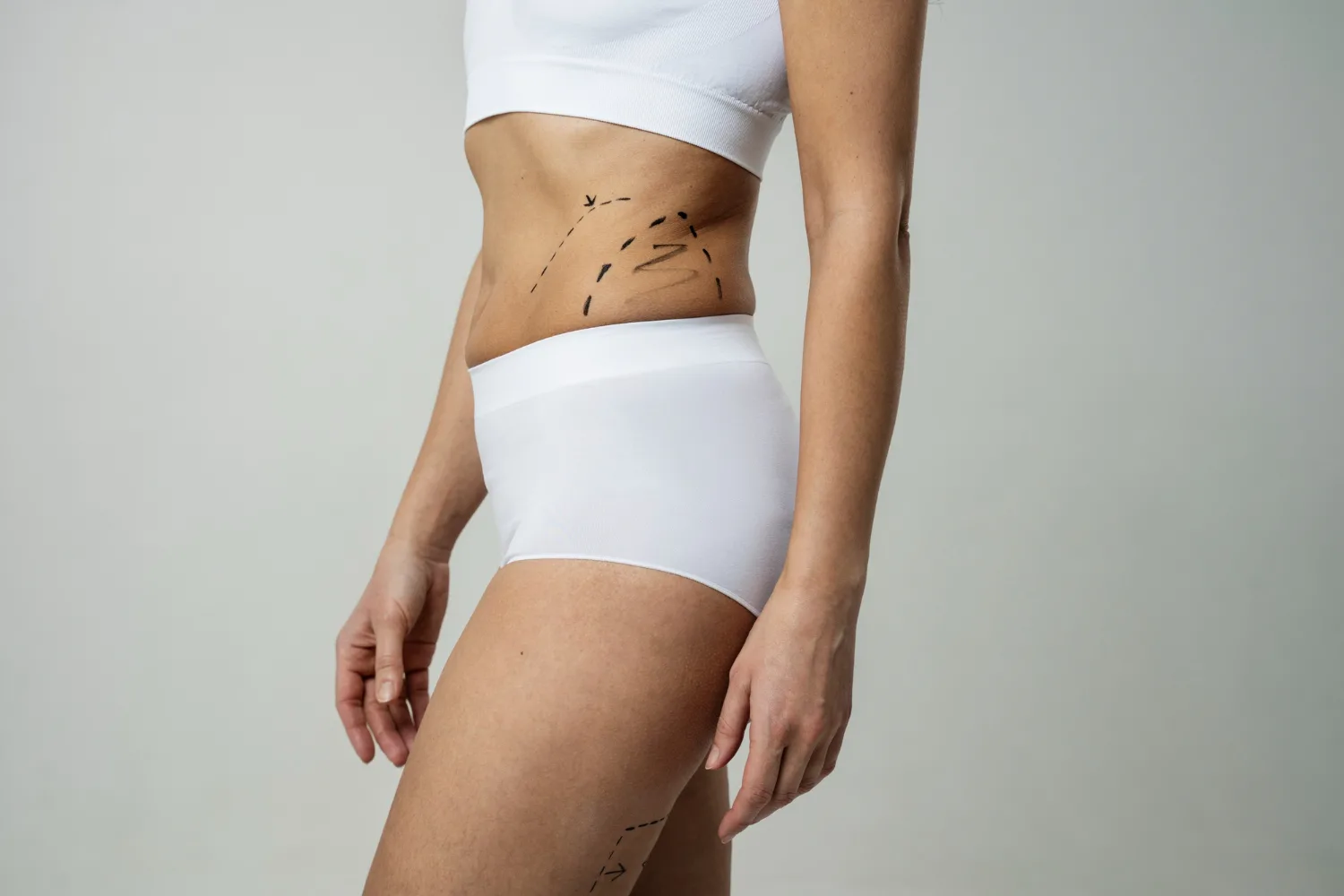 Your Journey to a Better Shape Starts with the Best Doctors in Dubai for Liposuction