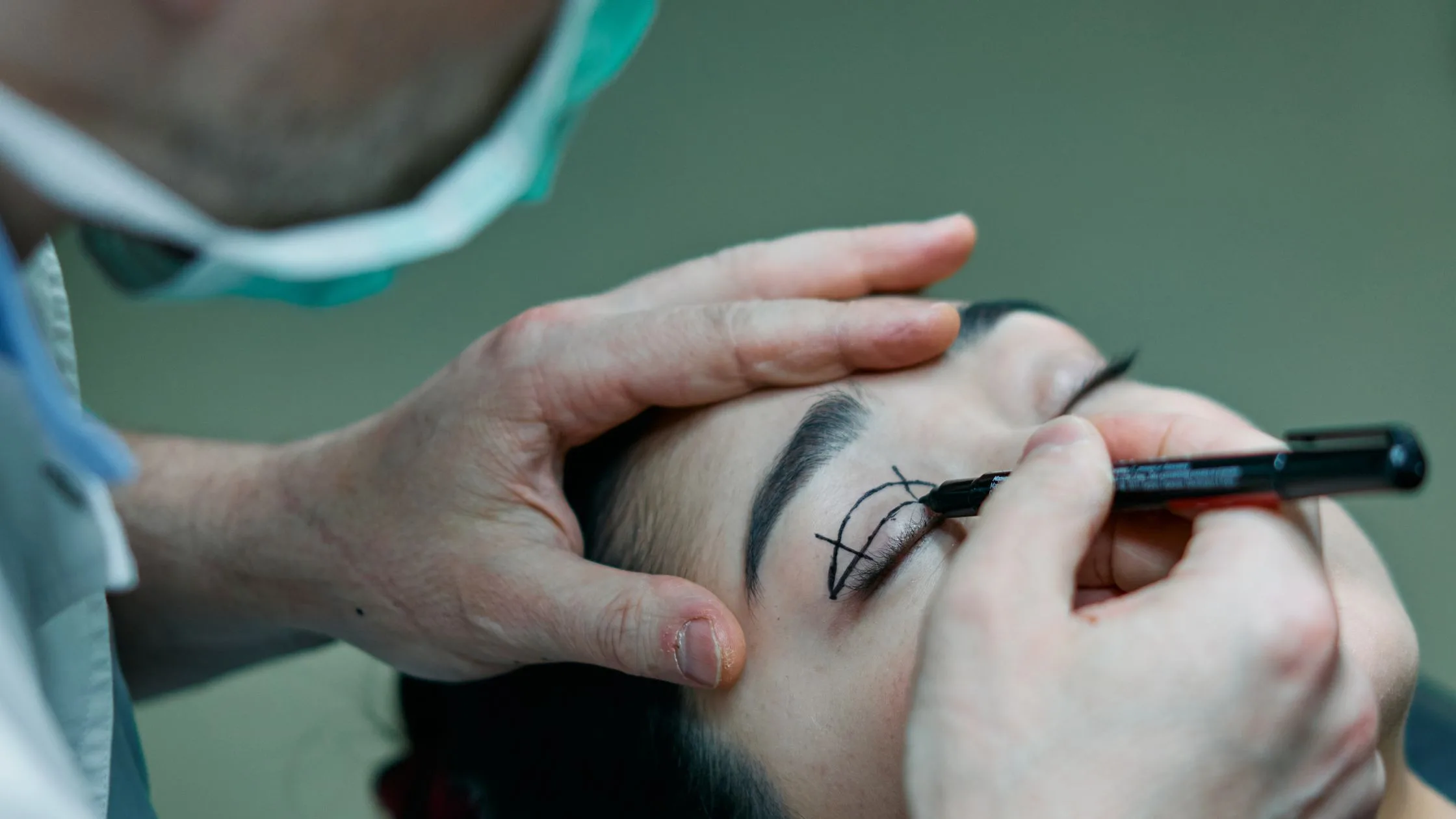 Tired Eyes, Timeless Confidence: Why Choosing the Best Blepharoplasty Surgeon in Delhi Matters