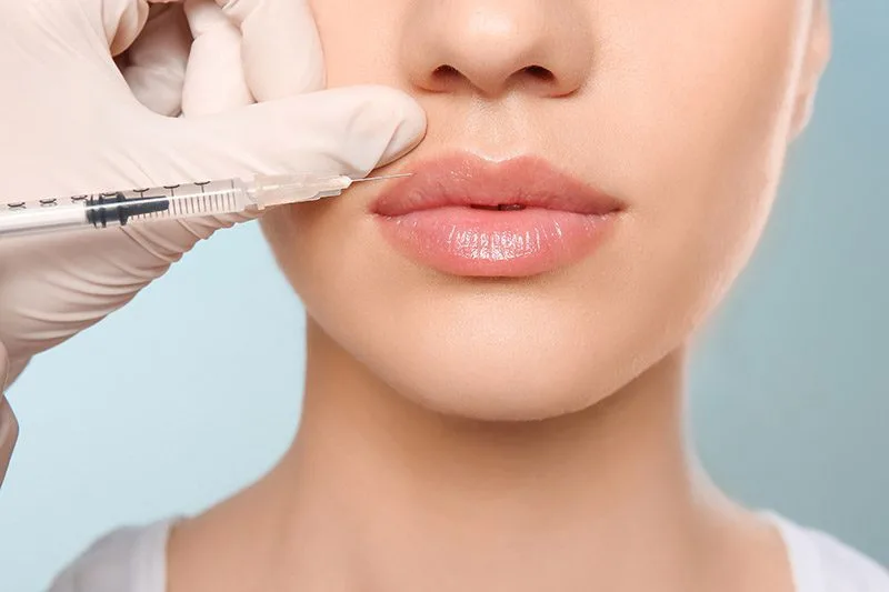 Dermal Fillers Explained: Benefits, Procedure and Results