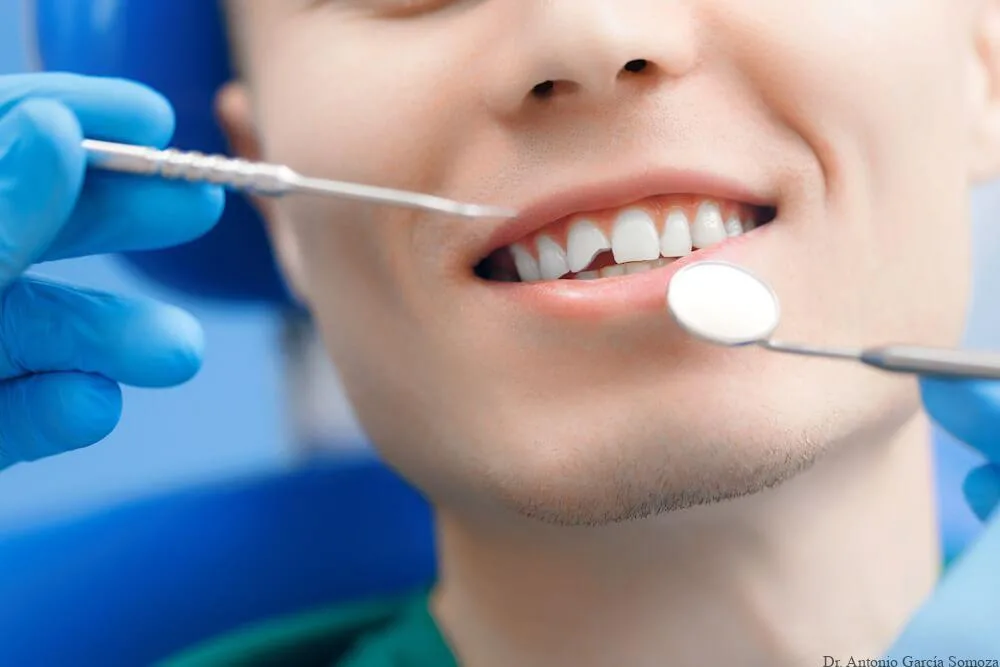 Emergencia Dental en Houston, TX: Cómo Actuar a Tiempo y Proteger tu Sonrisa