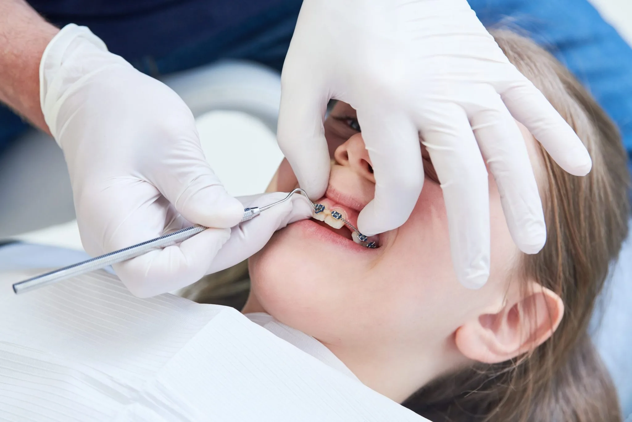 Finding the Right Smile Solution: Why Searching for an Orthodontist Near Me Matters