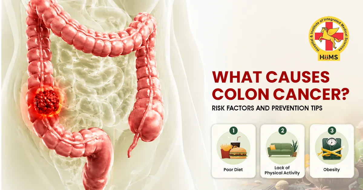 Colon Cancer Risk Factors: Causes, Warning Signs and Prevention