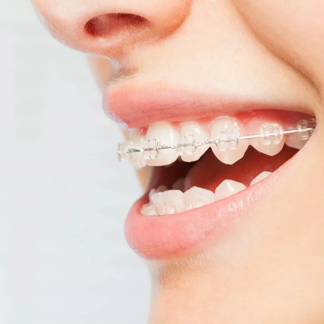 General Dentistry, Fairfax, VA for Preventive and Personalized Oral Care