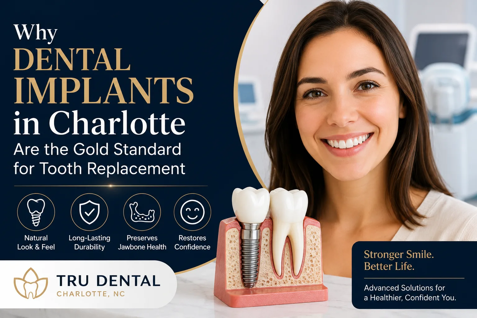 Why Dental Implants in Charlotte Are the Gold Standard for Tooth Replacement