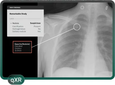 Healthcare AI Solutions: How Qure.ai Supports the Image-to-Intervention Journey