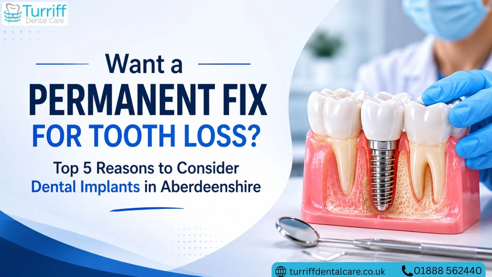 Want a Permanent Fix for Tooth Loss? Top 5 Reasons to Consider Dental Implants in Aberdeenshire