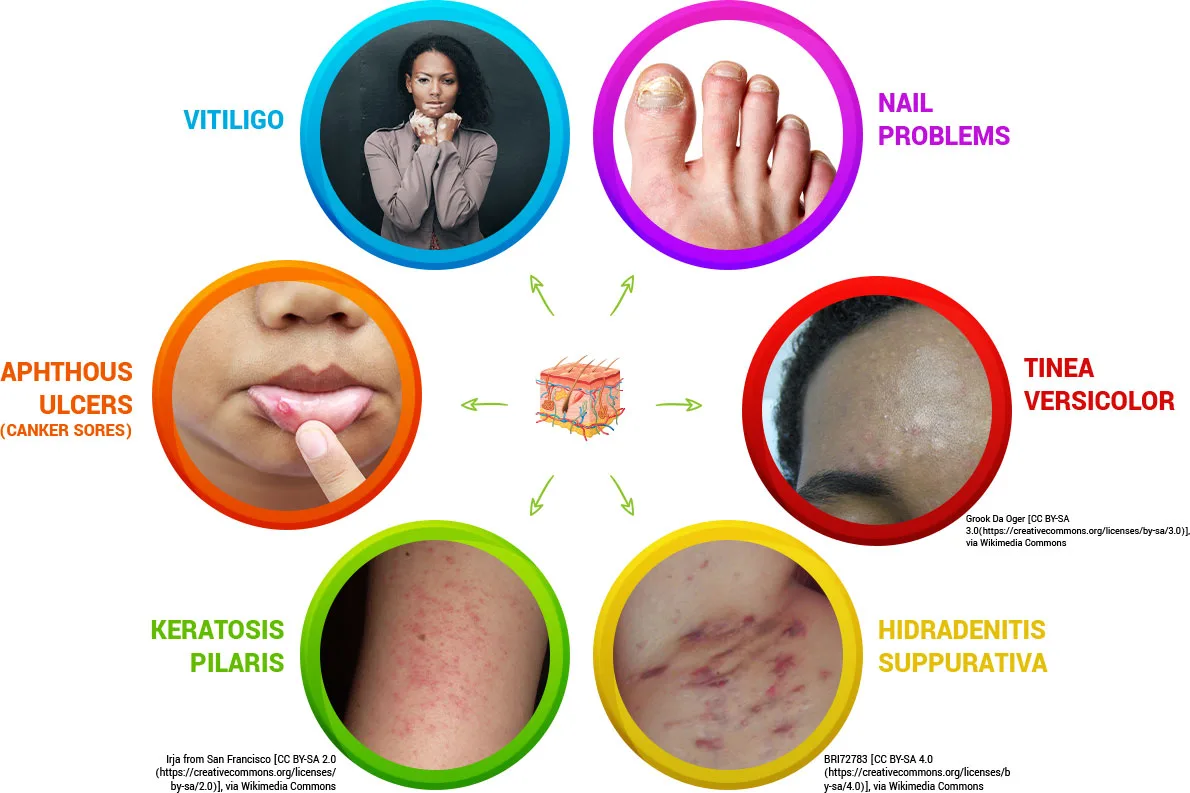 Hair Loss Treatment in Los Angeles: Causes and Care Options