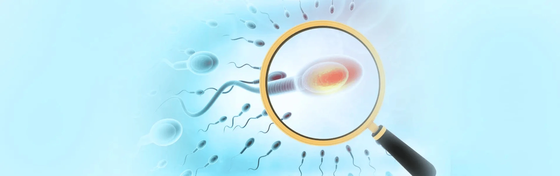 Y-chromosomal Microdeletions (YCMD)