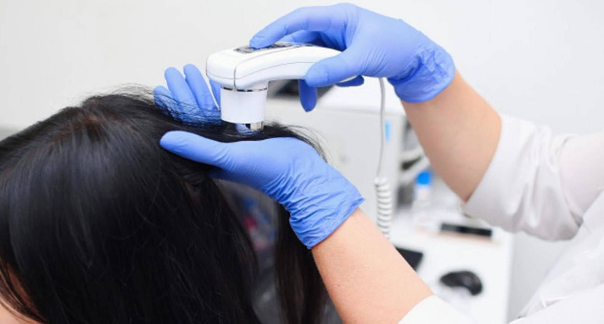 Regain Your Confidence: Best Hair Loss Treatments in Delhi