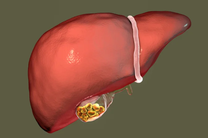 Best Gallstones Treatment in Mira Road