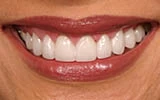 The Rise of Cosmetic Dentistry in Frisco: Transforming Smiles with Confidence
