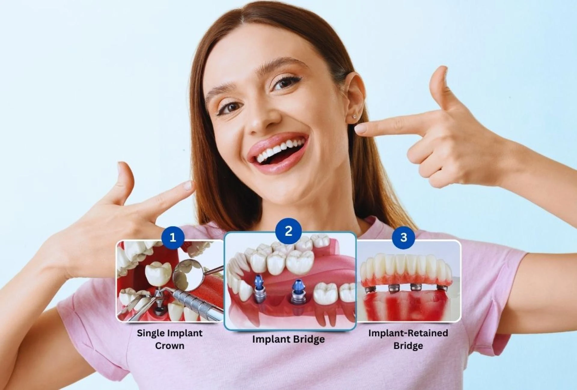 The Recovery Timeline After Dental Implant in Islamabad