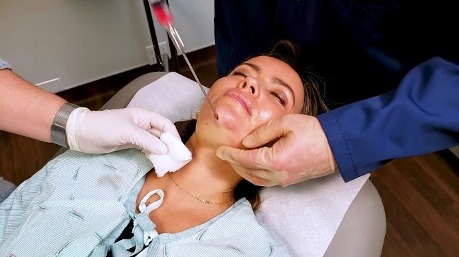 Everything you need to know about chin reduction surgery in Riyadh