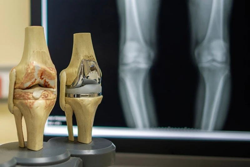 Orthopedic Health During Pregnancy : Tips for Expectant Mothers