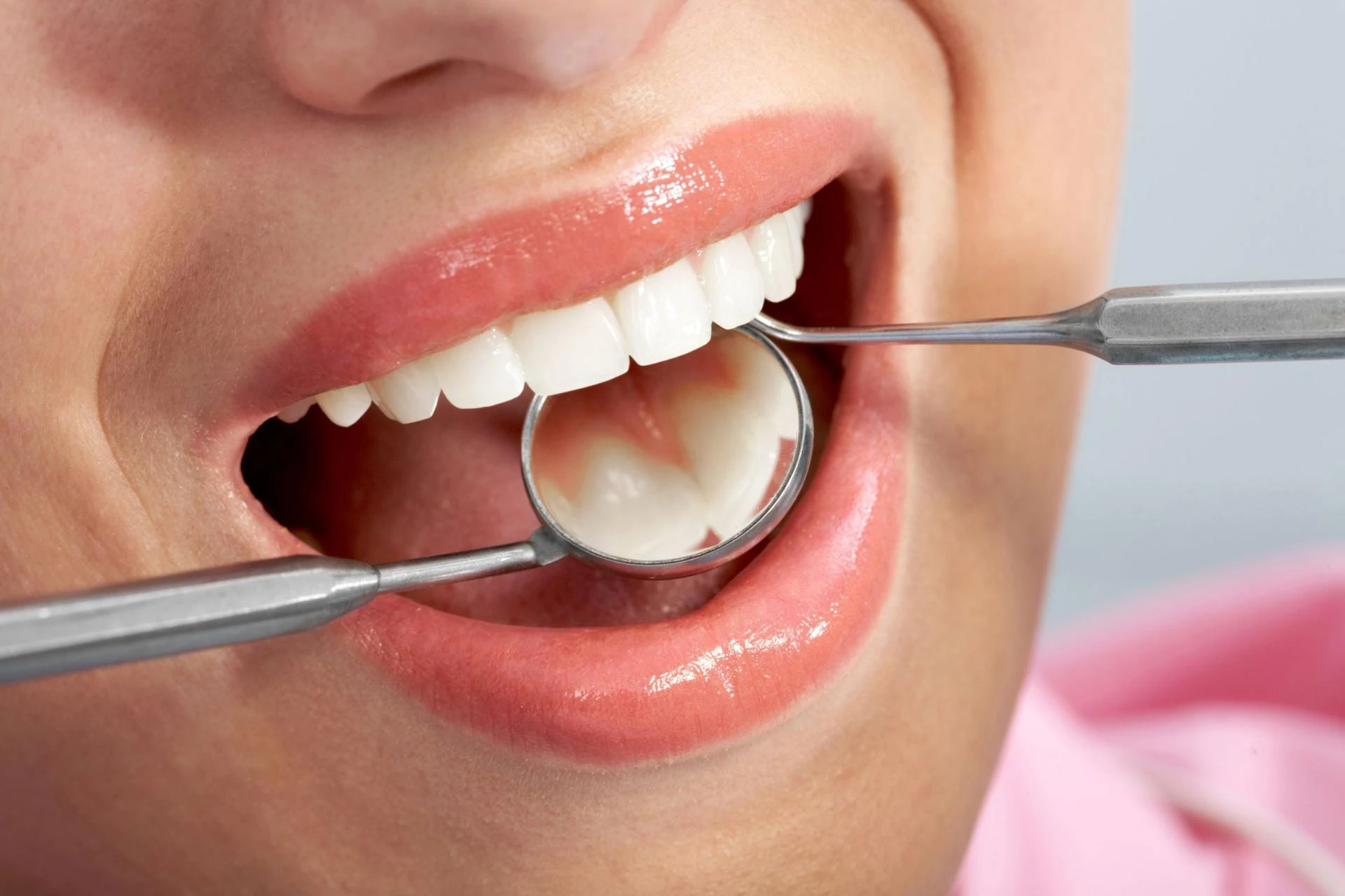 When Does Your Child Need a Dental Filling? Signs Parents Shouldn’t Ignore