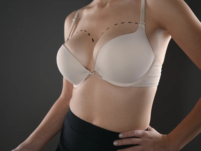 Breast Implants and Mammograms: Guide for Islamabad Patients