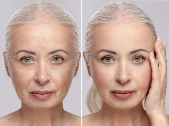 How Do I Choose a Clinic for Asian Skin Laser Treatment?