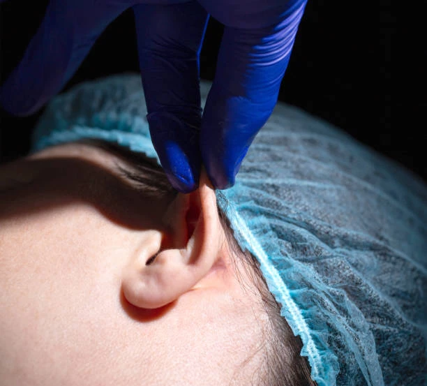 Otoplasty for Children in Dubai: When Is the Right Age?
