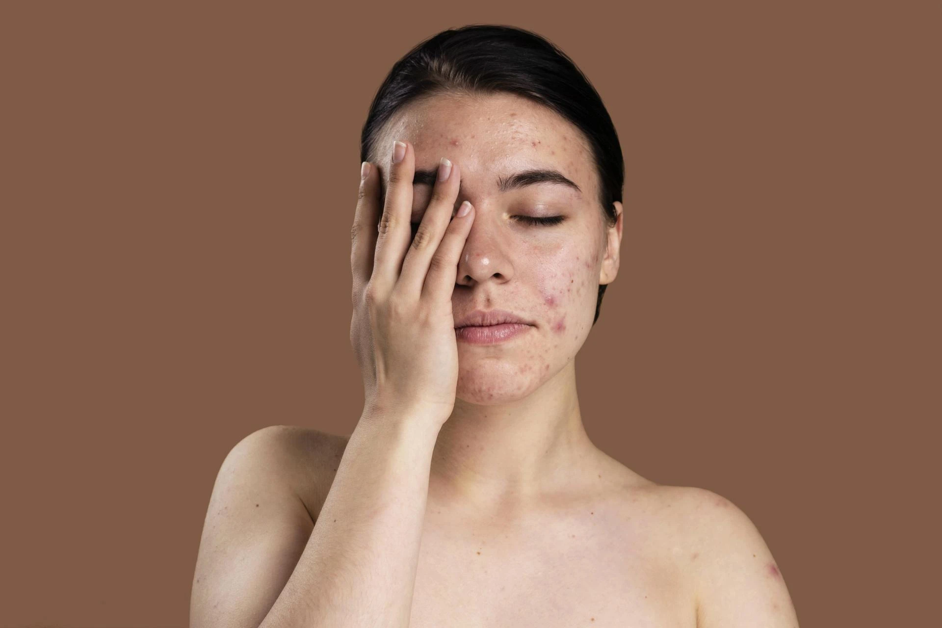 Post-Treatment Care Tips To Maximize Your Pigmentation Therapy Results?