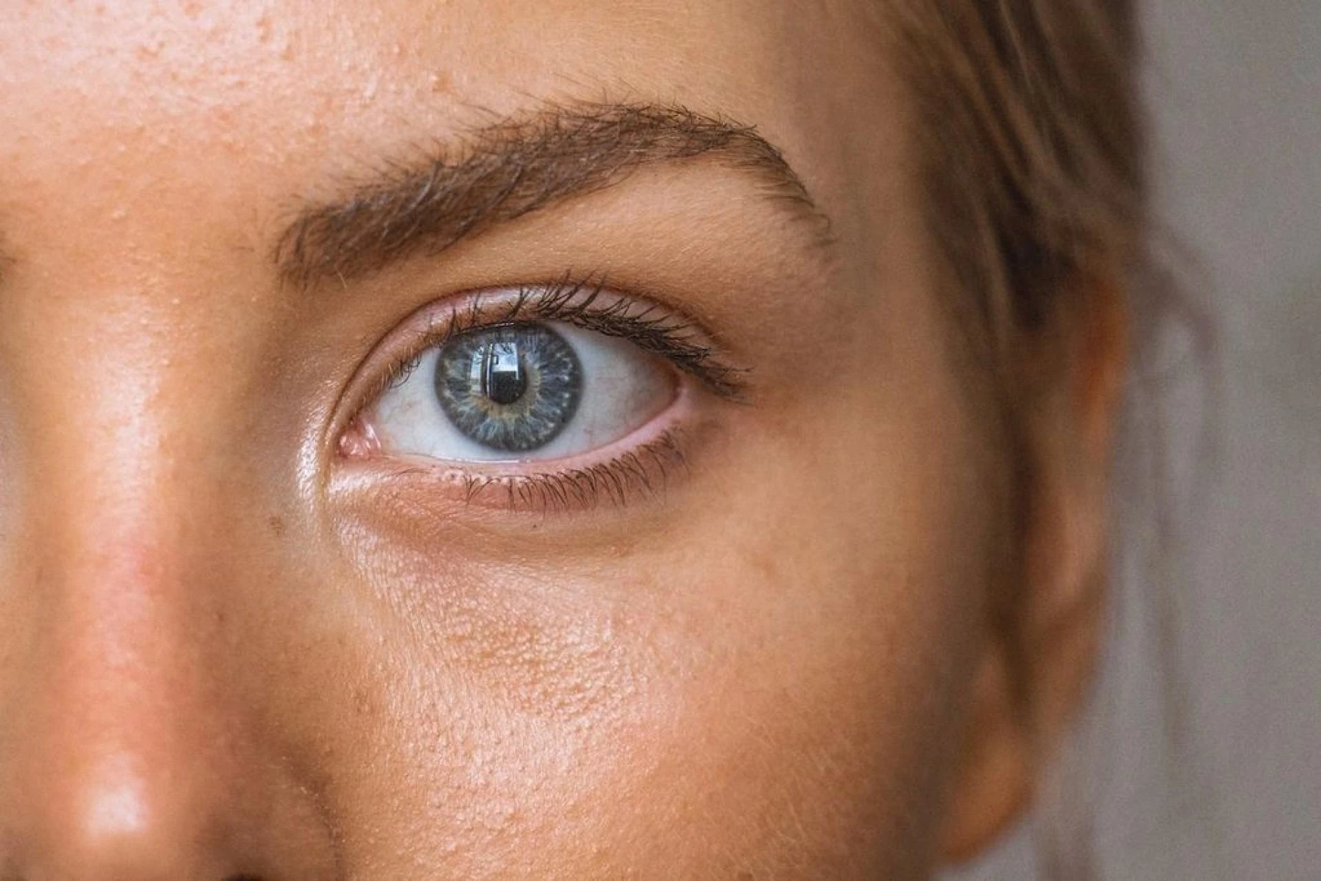 Drug Allergies and Rashes Can Reveal Hidden Health Issues