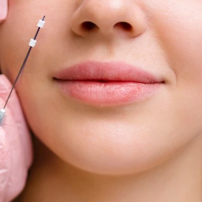  Does thread face lift really work?