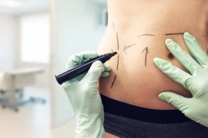 Transform Your Figure with Expert Tummy Tuck Care in Dubai