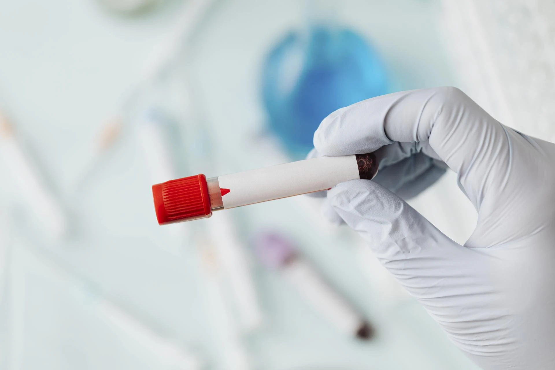 Understanding Low Energy: Causes, Testing, and How to Take Control of Your Health