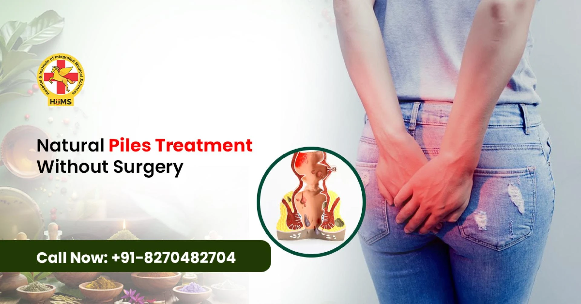 Piles Treatment Without Surgery: Gentle and Natural Ways to Find Relief