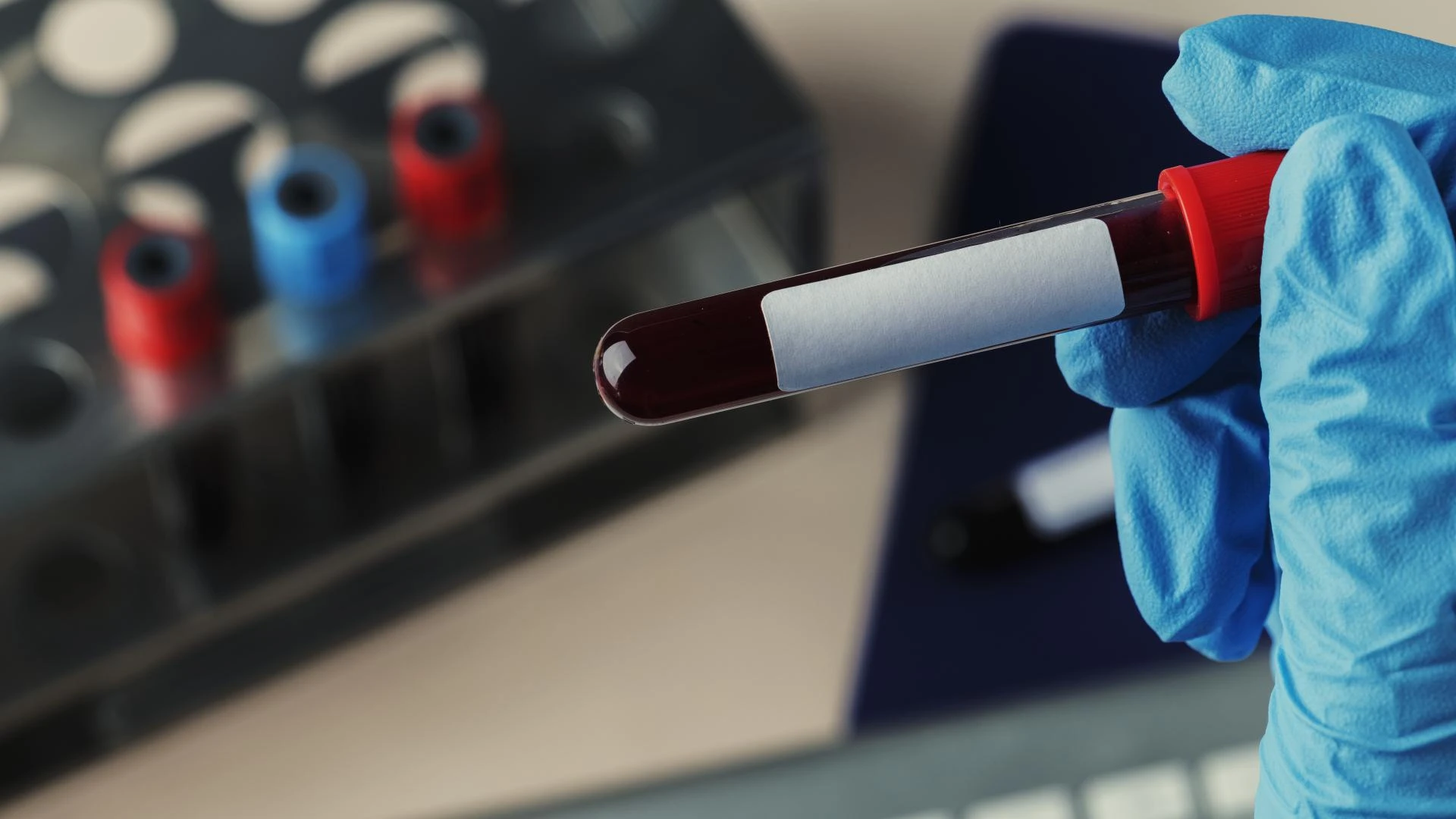 NIPT Test in London: A Complete Informational Guide