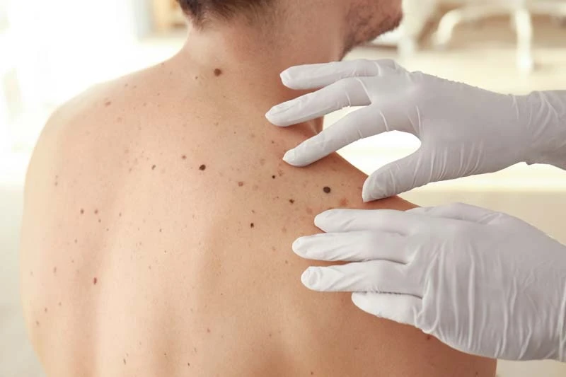 Expert Skin Cancer Care: Top Dermatology and Mohs Surgery in Fort Worth, TX