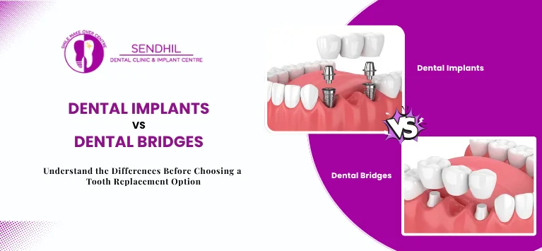 Dental Implants vs Dental Bridges