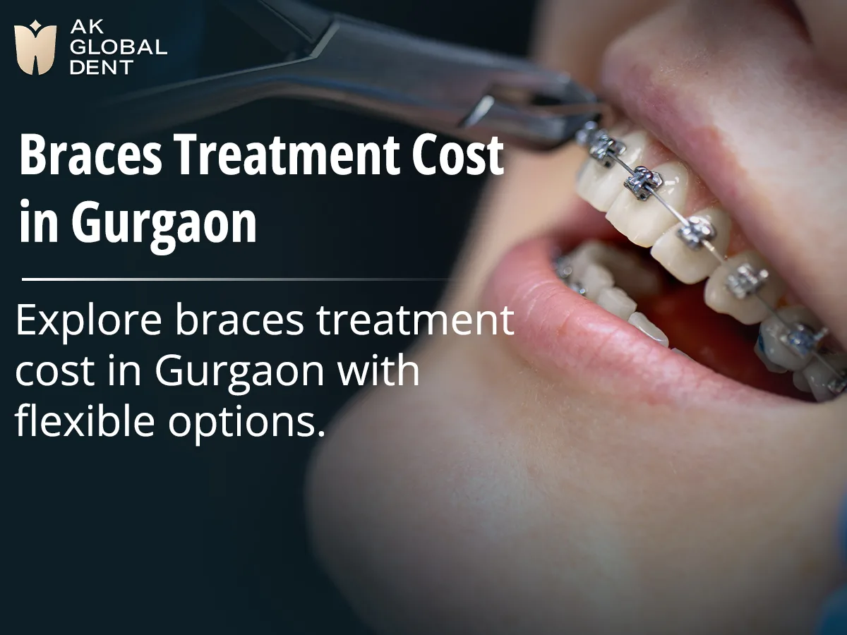 Your Complete Guide to Getting Braces in Gurgaon: What You Need to Know